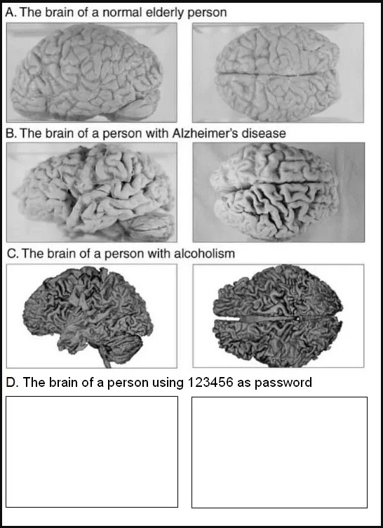 brain.jpeg