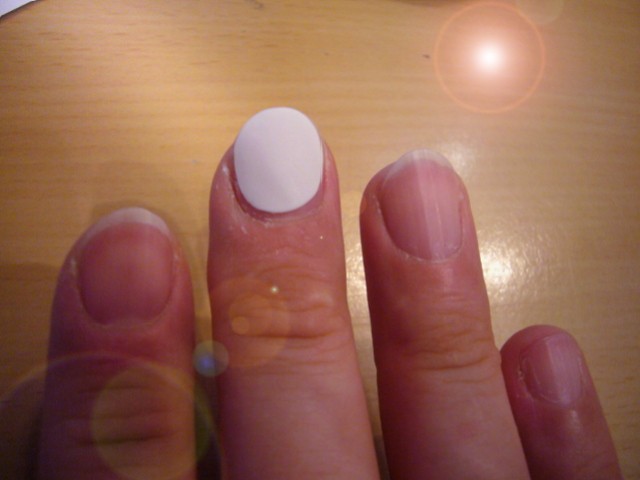 Fingernagelreparatur-s.JPG