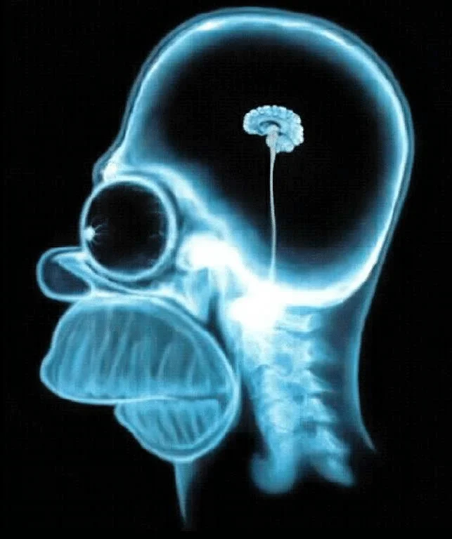 Homer brain.webp