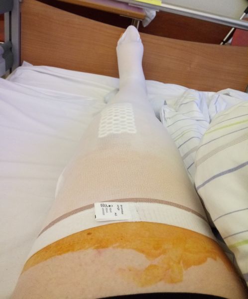 Knie2.jpg