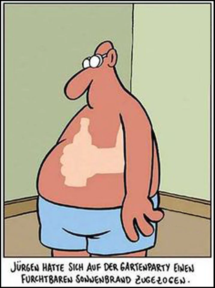 Witz Sonnenbrand4_2.webp