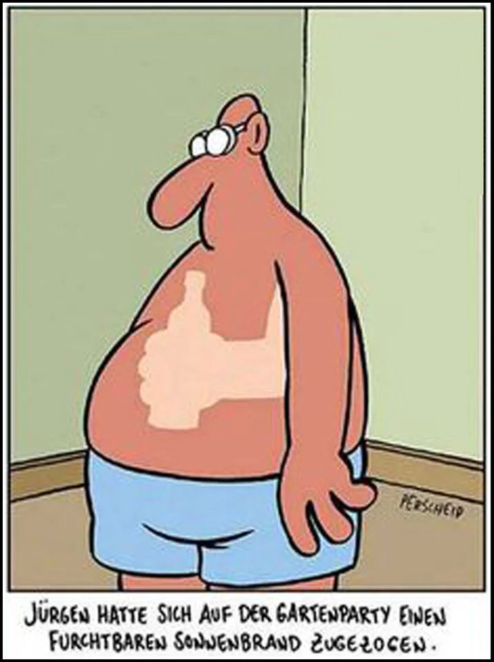 Witz Sonnenbrand4_2.webp