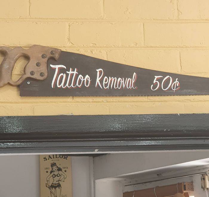 Witz_Tattoo_Removal.jpg