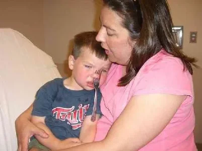 Gabel in der Nase.webp