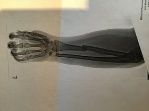 18A3DAE3-BF16-4645-AE51-745BD5D6D7F8.jpeg 18A3DAE3-BF16-4645-AE51-745BD5D6D7F8.jpeg