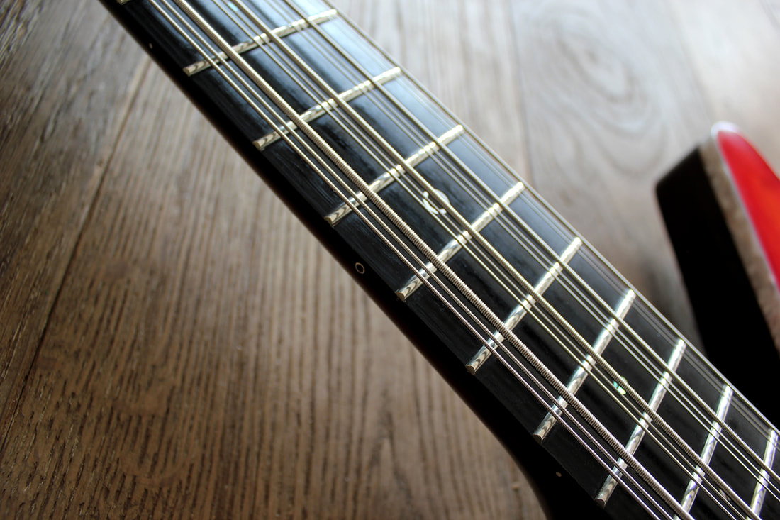 brooks-exb-12-sa-inlays-1500_orig.jpg