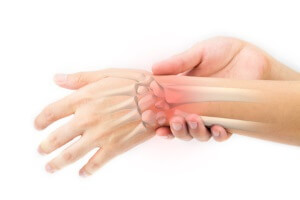 Radiocarpalarthrose-Handgelenk.jpg